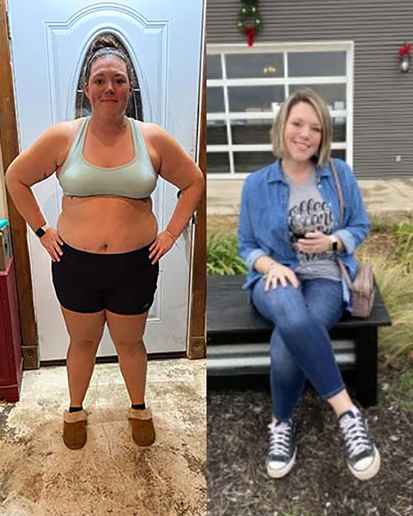 Weight Loss Surgery Austin - Meet Lyndsie