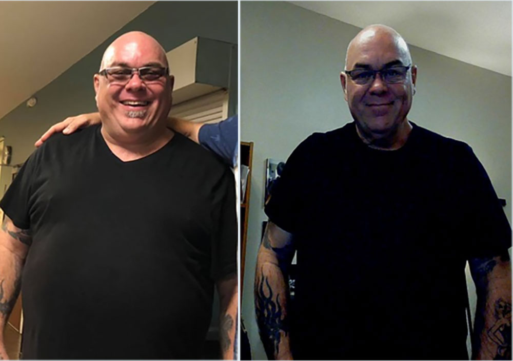 Weight Loss Surgery Austin - Meet Chris