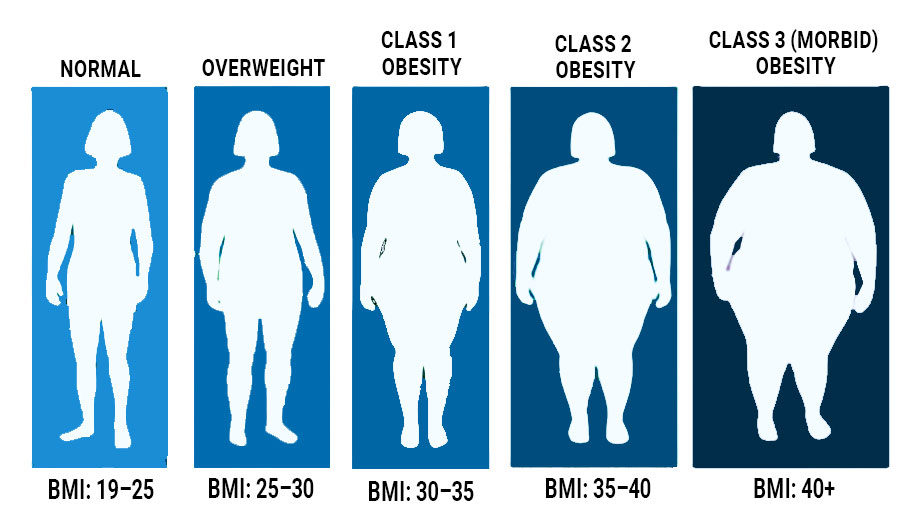 Understanding BMI and Obesity